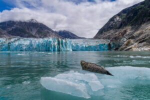 トレーシーアーム
